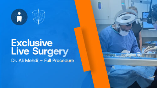 Live-On-X: Full Upper Arch Implant Rehabilitation